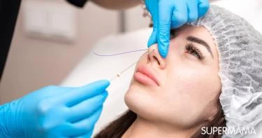 تجميل الأنف بالخيوط 